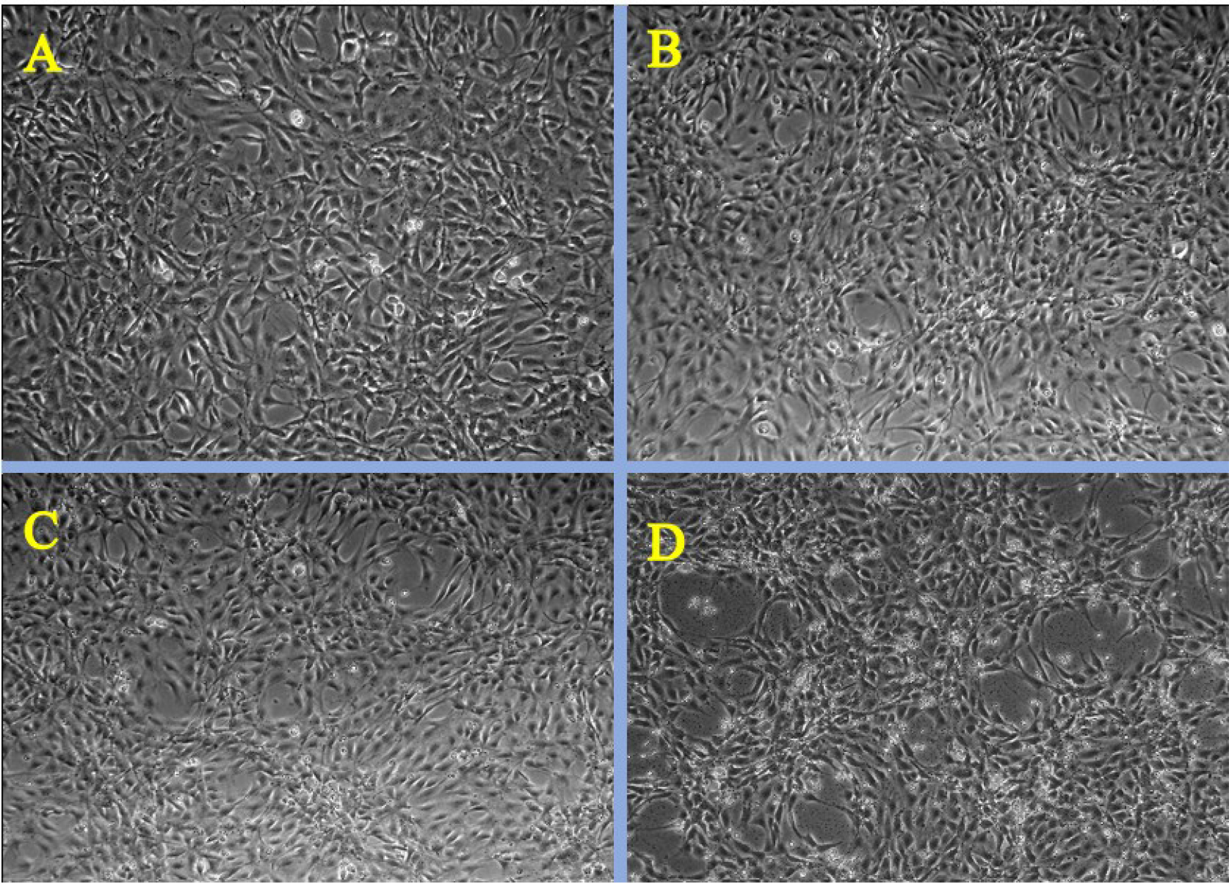 Phase contrast microscopy images of Citrus limonum mediated hydroxy apatite nanoparticles at different concentrations A) control B) 3.175 µg/mL C) 25 µg/mL D) 200 µg/mL.