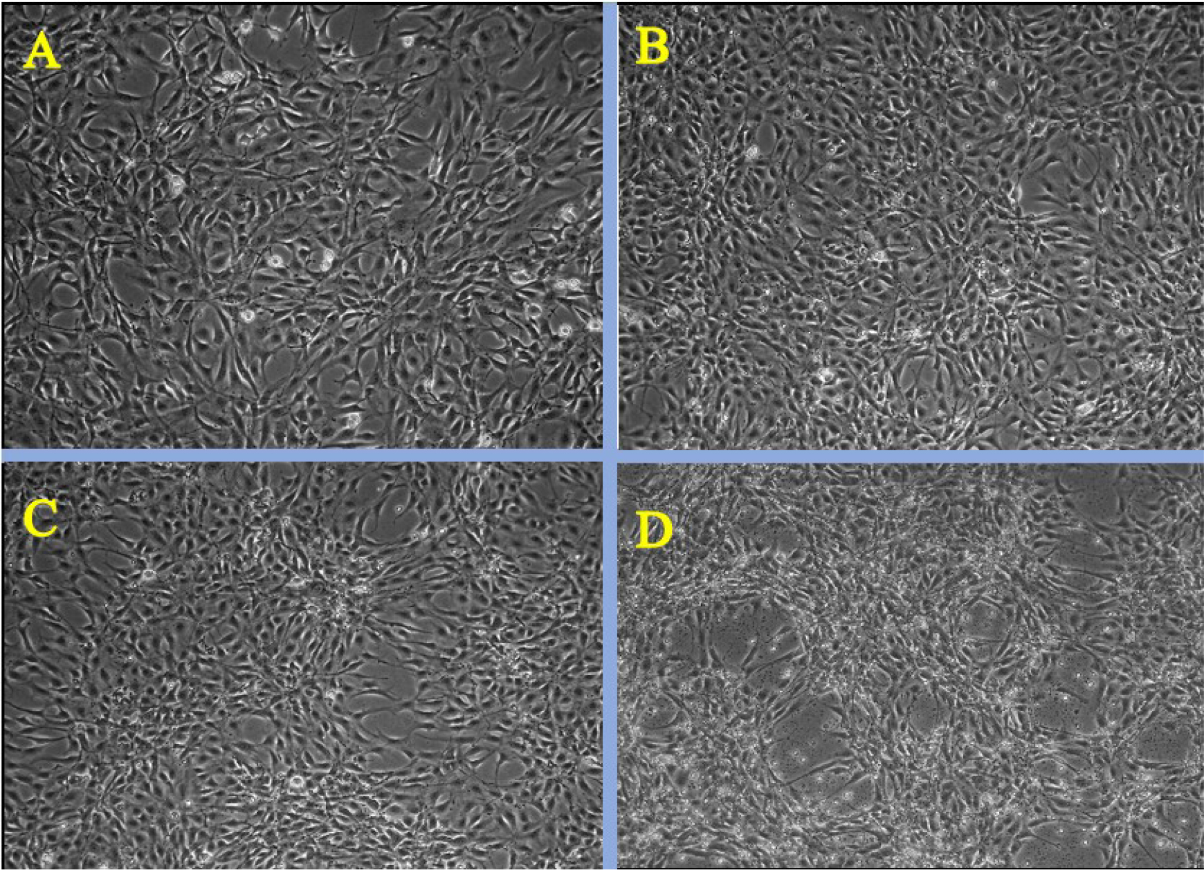 Phase contrast microscopy images of Citrus reticulata mediated hydroxy apatite nanocomposites at different concentrations A) control B) 3.175 µg/mL C) 25 µg/mL D) 200 µg/mL.