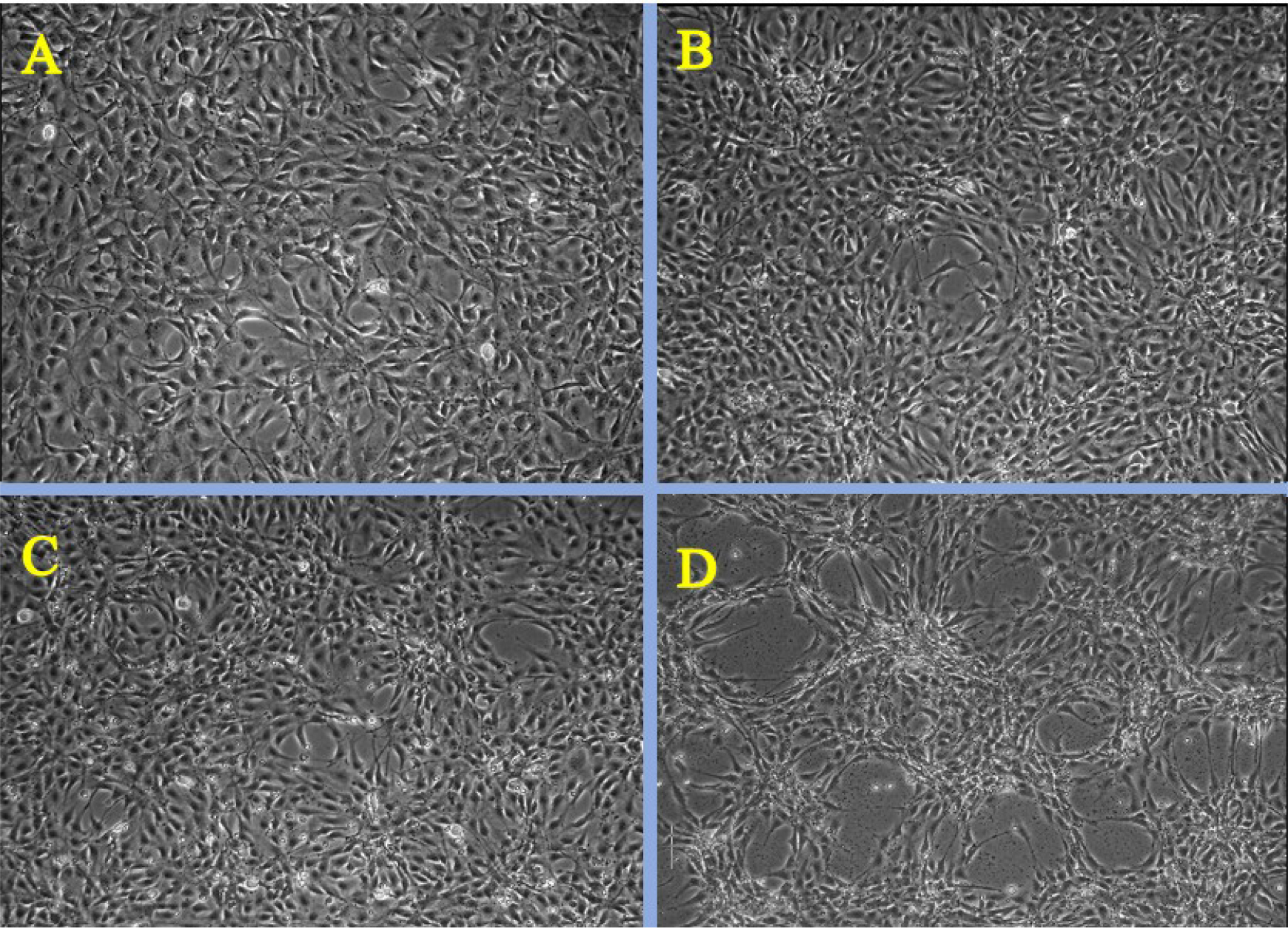 Phase contrast microscopy images of Citrus limonum mediated hydroxy apatite nanocomposites at different concentrations A) control B) 3.175 µg/mL C) 25 µg/mL D) 200 µg/mL.
