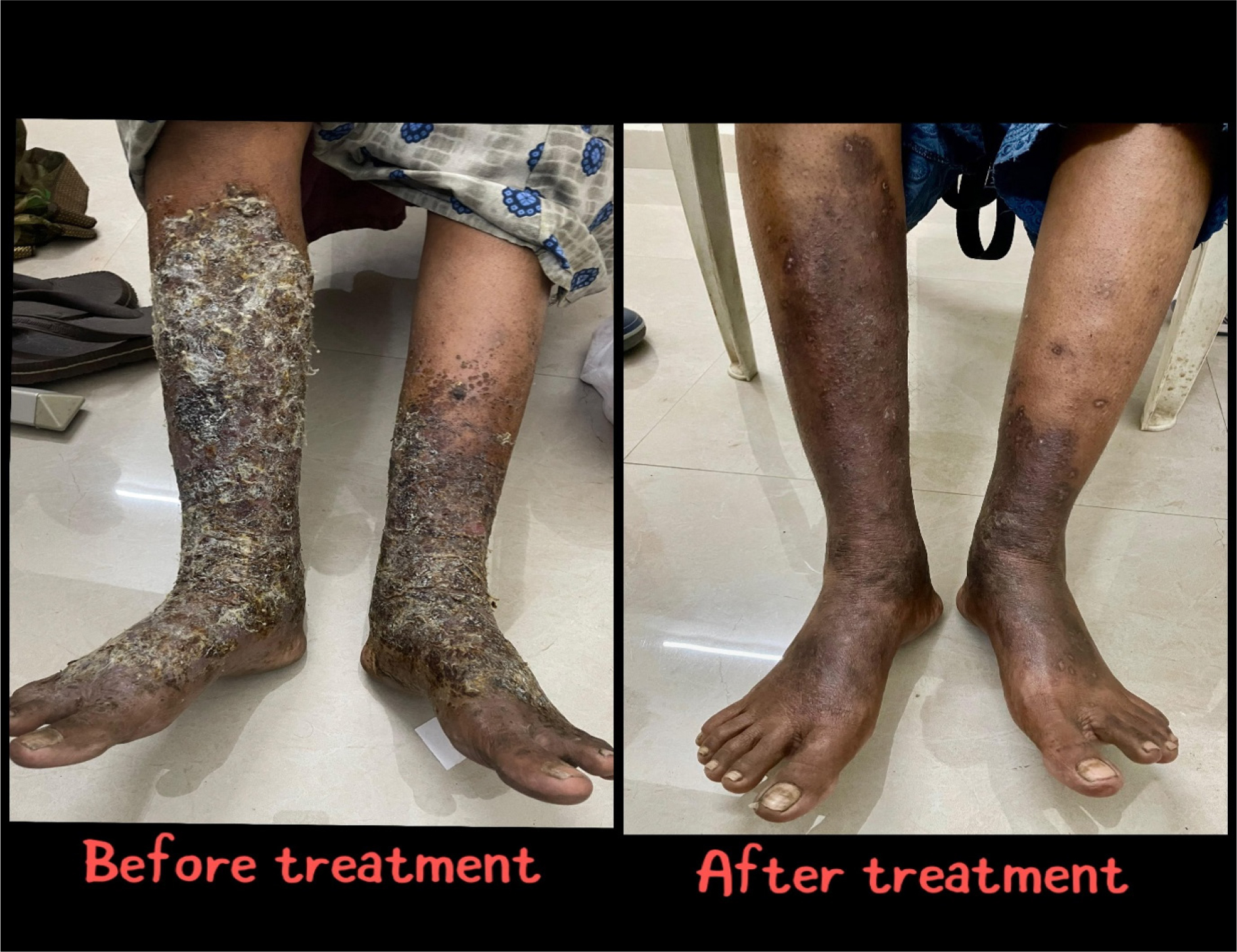Before and after treatment difference in patient’s symptoms.