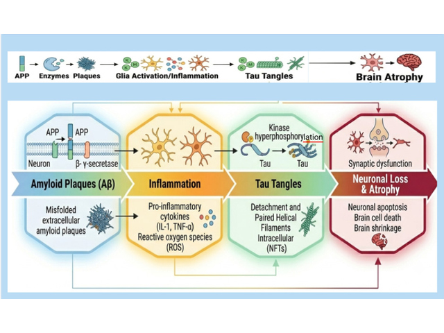Artificial Intelligence-Based Biomarkers and Neuroimaging Approaches for Early Detection and Diagnosis of Alzheimer's Disease: A Comprehensive Review