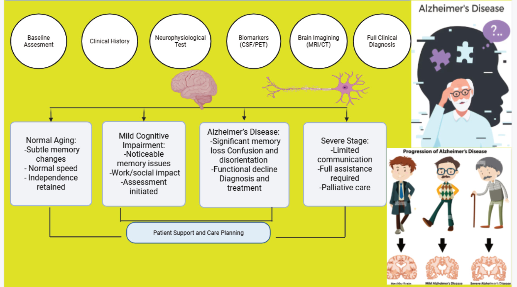 Overview of Alzheimer's disease progression and diagnostic pathway.