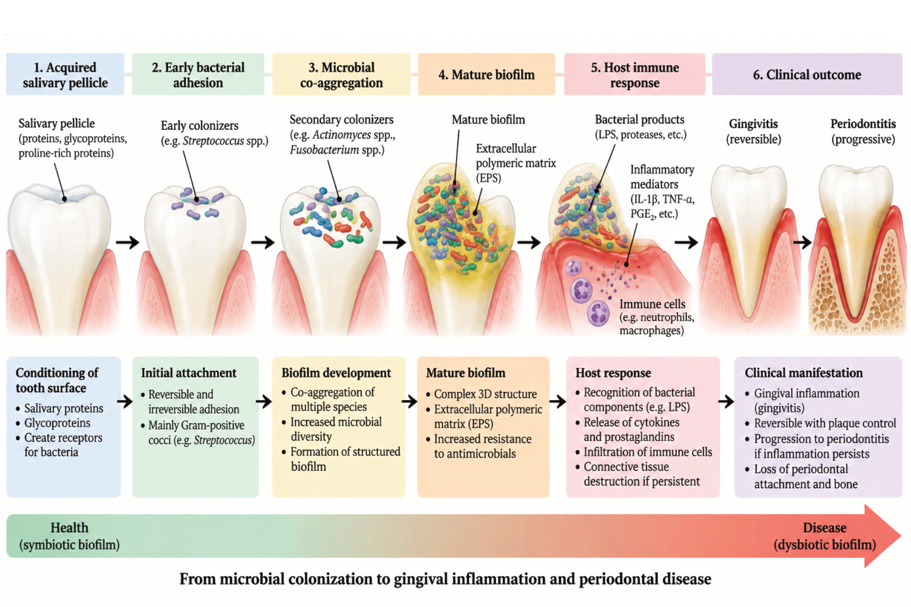 Schematic representation of oral biofilm formation and its association with gingival inflammation.