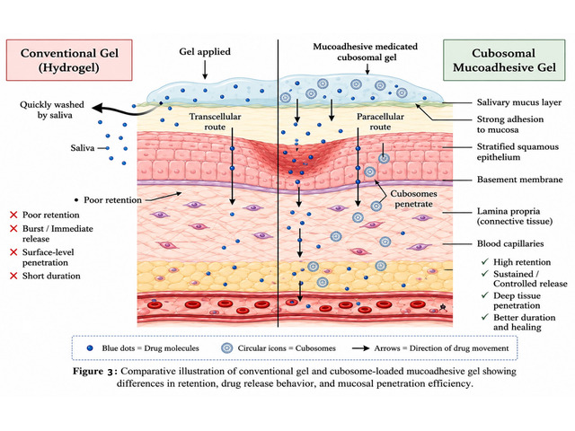 Cubosomes as Advanced Nanocarriers for Oral Ulcer Treatment: A Review on Their Role in Enhancing Therapeutic Activity