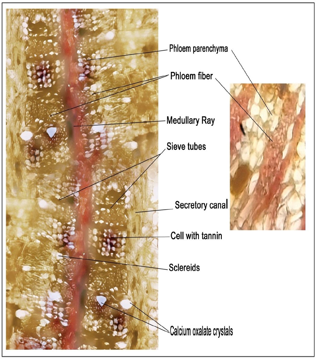Transverse section of Soymida febrifuga (Roxb.) A. Juss. stem bark.