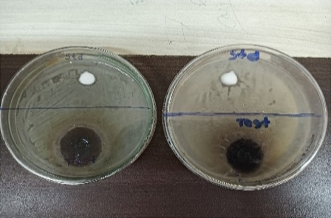 In vitro Antifungal activity.