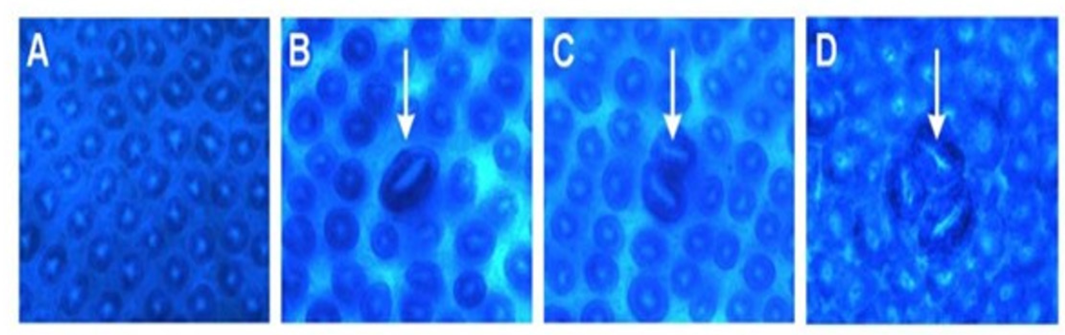 Representative blood smear morphology: (A) Normal control showing uniform erythrocytes; (B) DMH + HFD group showing abnormal cell morphology; (C) Kefir-treated group showing partial improvement; (D) MLECC + kefir group showing near-normal cell structure.