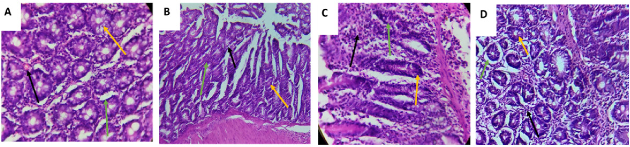 Representative histopathological sections of colon tissue (H&E, 40×): (A) Normal architecture in control group; (B) Distorted crypts and dysplasia in DMH + HFD group; (C) Partial restoration in kefir-treated group; (D) Improved mucosal and glandular structure in MLECC + kefir co-treated group.