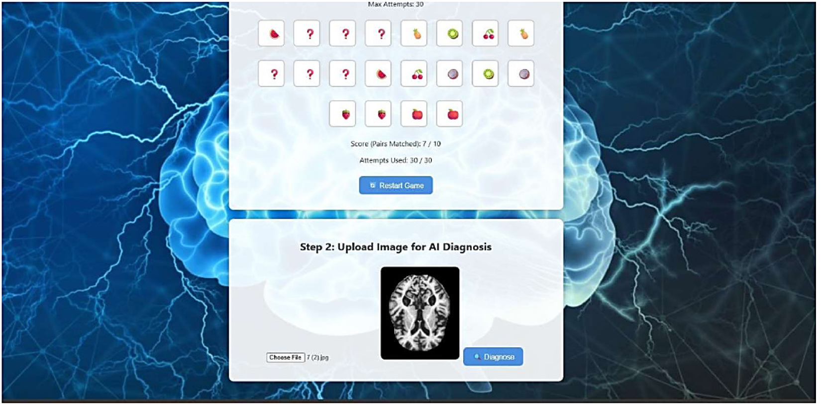 Web Page of Alzheimer’s AI Diagnostic tool containing cognitive game along with image classification.