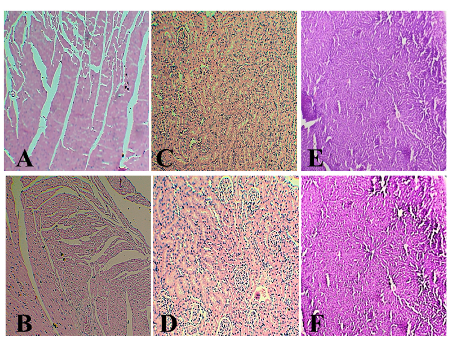 A-Photograph of section female Wistar rat of the heart (control) & B-MO AgNPs treated heart shows normal myocardium and pericardium; C-kidney (control) & D-MO AgNPs treated kidney shows normal glomeruli and tubules without lesions of pathological significance; E-liver (control) & F-MO AgNPs treated liver shows no sign of inflammation and hepatocytes are normal.