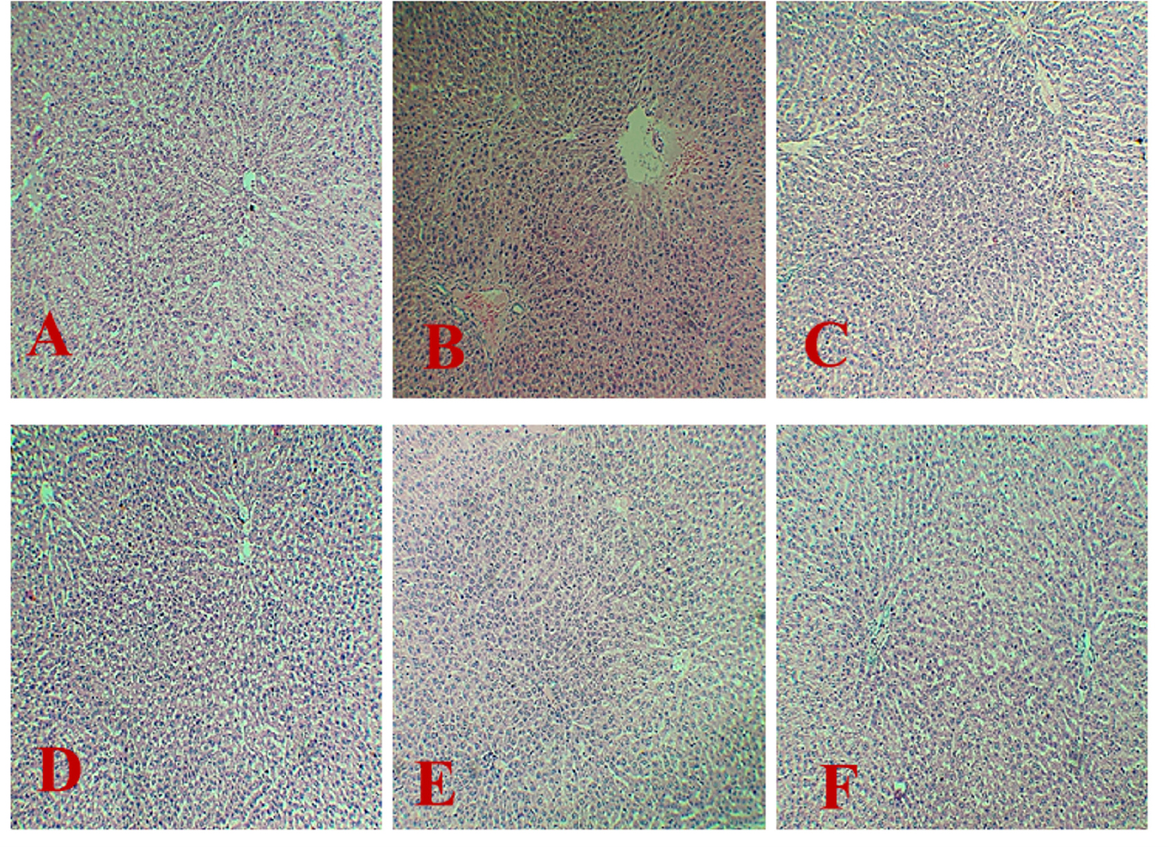 A-Histopathology of Wistar rats in normal control group (I); B-paracetamol treated group (II); C-silymarin treated standard group (III); D-Moringa extract (200 mg/kg) treated group (IV); E-AgNPs (200 mg/kg) treated group (V); F-AgNPs (100 mg/kg) treated group (VI).