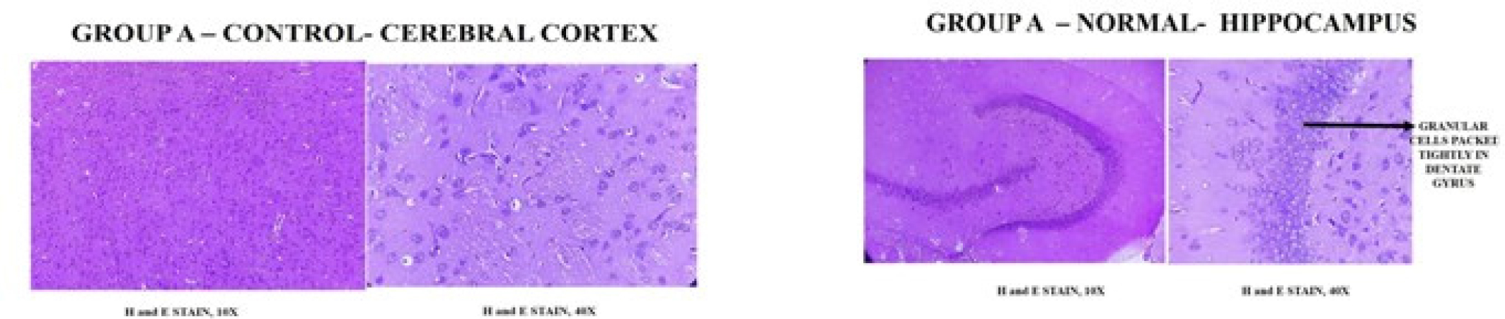 Group I - Distilledwater (p.o) treated group. H and E stained section shows brain with Hippocampus and ce rebral cortex. The hippocampus proper show layers of pyramidal cells and dentate gyrus show densely packed granular cells. The cerebral cortex show granular cells, pyramidal cells, blood vessels.