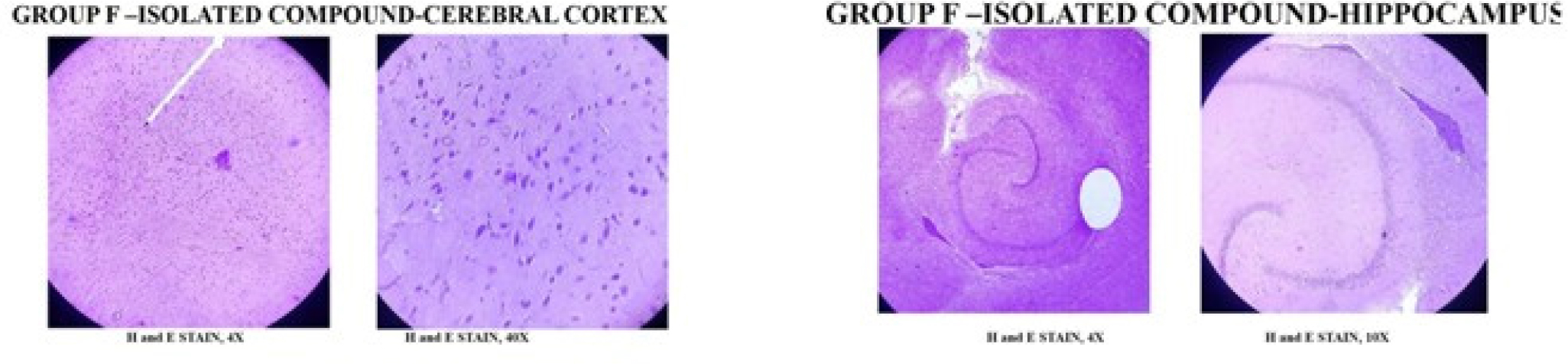 Group VI- AlCl3 (17 mg/kg/p.o) + Afzelechin (30 mg/kg, p.o). H and E stained section shows normal hippocampus and cerebral cortex. Lateral ventricle size is normal.