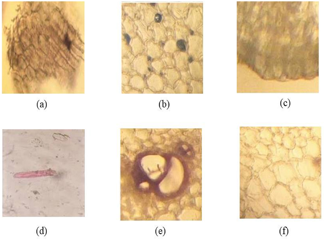 Powder microscopy showing diagnostic characters.