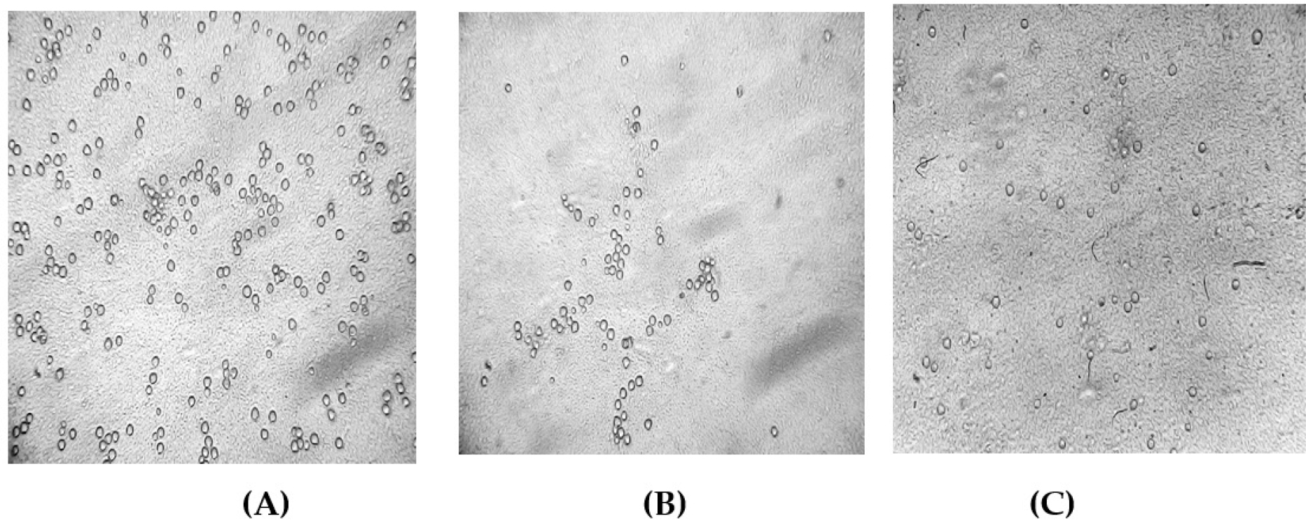 Morphological changes in A549 (Lung Cancer) cells. (A) Untreated control cells showing a healthy, confluent monolayer. (B) Cells treated with 5-FU showing significant cell death and detachment. (C) Cells treated with Swarnavari Bhasma (100 µL/mL) showing reduced cell density, rounding, and shrinkage.