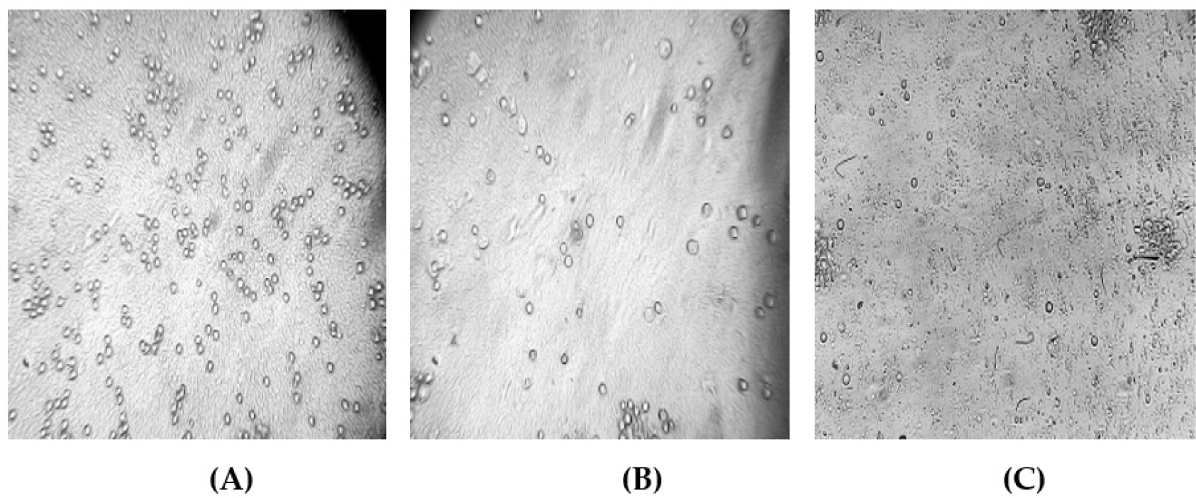Morphological changes in MCF-7 (Breast Cancer) cells. (A) Untreated control cells. (B) Cells treated with 5-FU. (C) Cells treated with Swarnavari Bhasma (100 µL/mL), showing pronounced cytotoxicity.