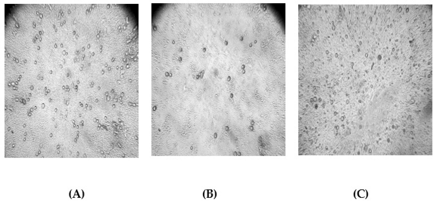 Morphological changes in PC-3 (Prostate Cancer) cells. (A) Untreated control cells. (B) Cells treated with 5-FU. (C) Cells treated with Swarnavari Bhasma (100 µL/mL).