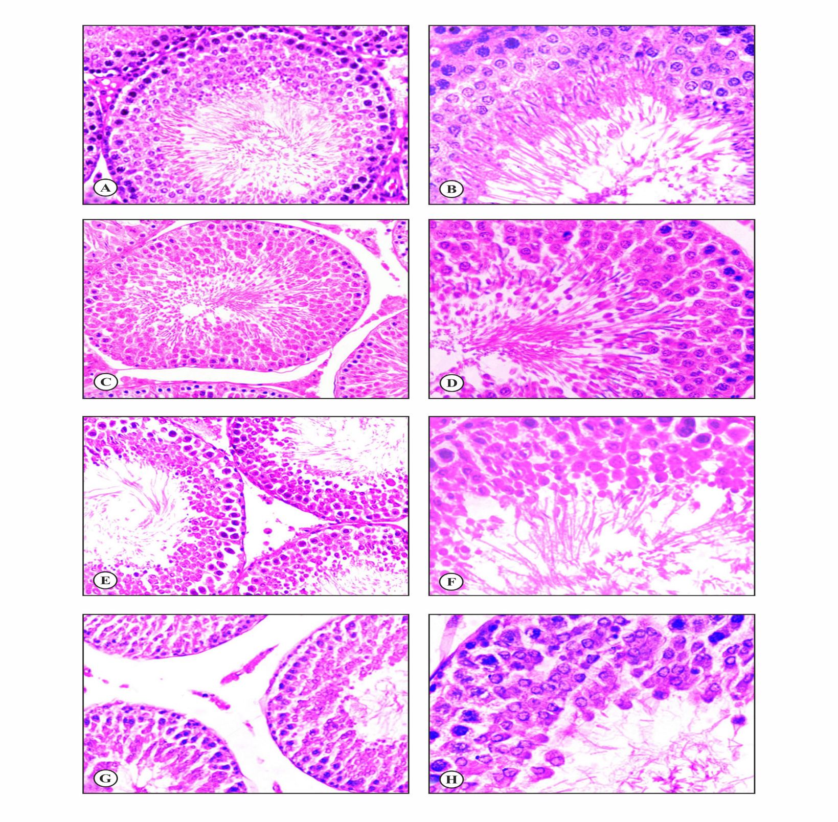 Photomicrographs of rat testis showing dose-dependent histological changes following P. pinnata extract treatment. The control group exhibits normal testicular histoarchitecture and orderly spermatogenesis with a characteristic tiered arrangement of germ cells (A: ×200; B: ×400). Rats treated with 100 mg/kg/day show degenerative changes, including shrinkage of seminiferous tubules, impaired spermatogenesis, and presence of sperm debris in the tubular lumen (C: ×200; D: ×400). At 200 mg/kg/day, degeneration is more pronounced with arrest of spermatogenesis at the secondary spermatocyte stage, disorganization of the seminiferous epithelium, loss of post-meiotic germ cells, and reduced spermatozoa (E: ×200; F: ×400). Treatment with 300 mg/kg/day results in marked shrinkage of seminiferous tubules, increased intertubular space, severe depletion of germ cells, and profound disruption of spermatogenesis with abundant luminal sperm debris (G: ×200; H: ×400) (H.E.).