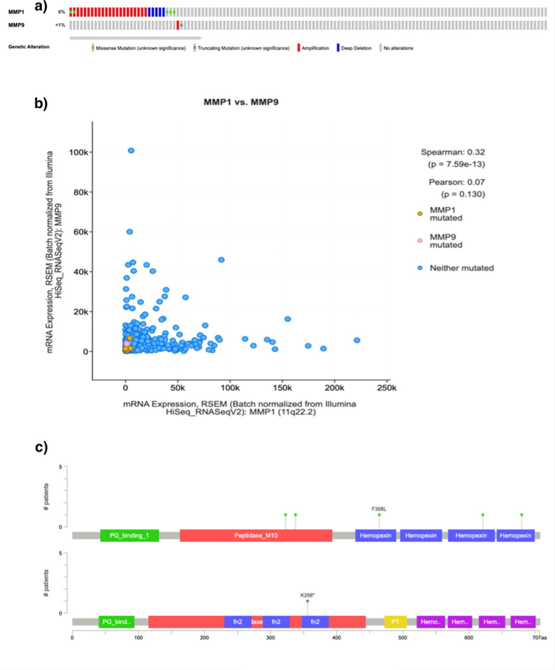 a) Mutation in target genes, MMP1 and MMP9, from cBioportal, b) Co-expression analysis using cBioPortal between MMP1 and MMP9. c) Frequency and location of genetic alterations in MMP1 and MMP9.