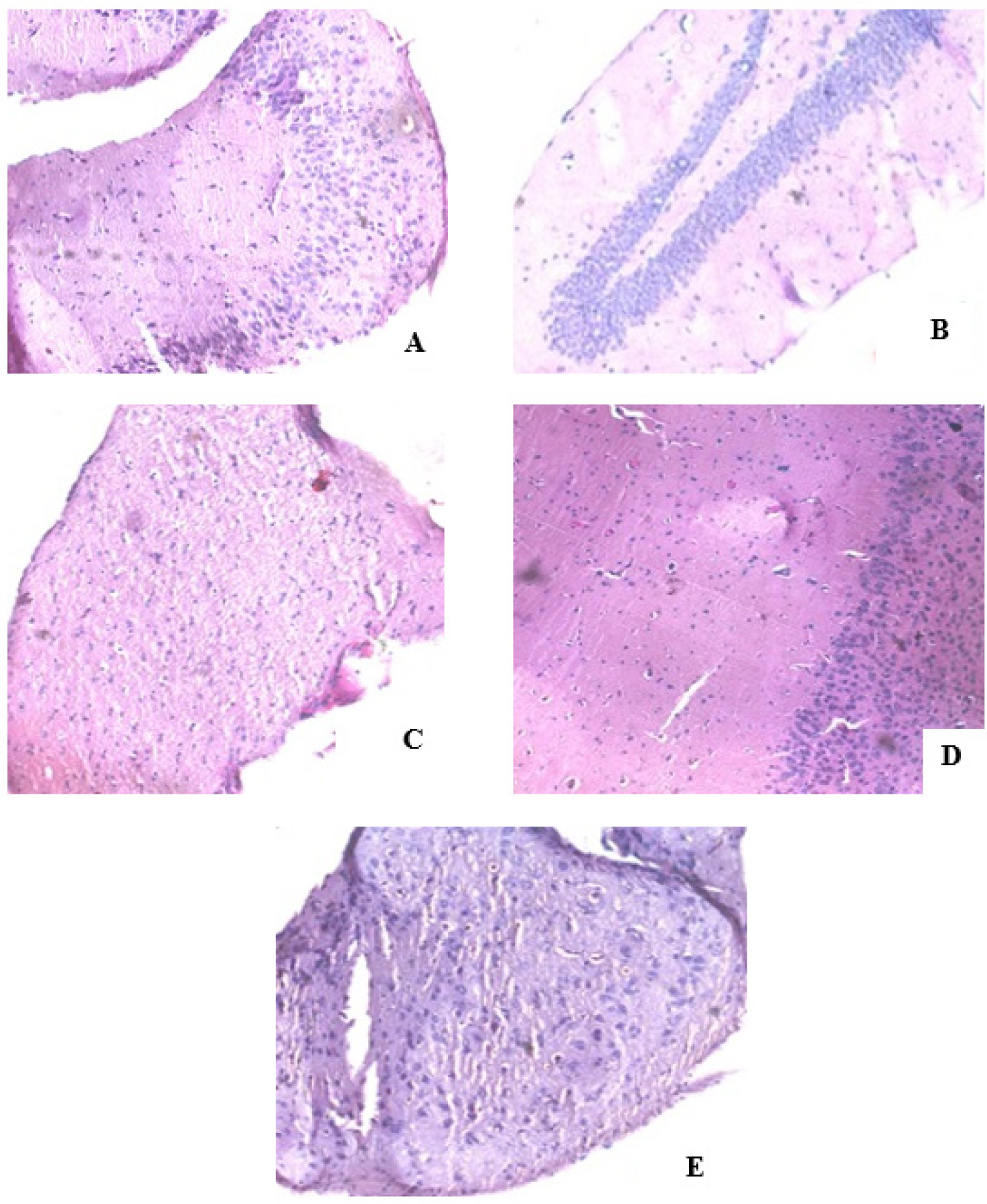 Histopathological examination of brain hippocampus (H & E stain, 400x). A: Photomicrograph showing the histological architecture of brain hippocampus in the Normal group; B: Photomicrograph showing the histological architecture of brain hippocampus in the Sham control group; C: Photomicrograph showing the histological architecture of brain hippocampus in the Vehicle (Disease Control, Aβ1-42) group; D: Photomicrograph showing the histological architecture of brain hippocampus in the Standard (TPPU, 1 mg/kg) group; E: Photomicrograph showing the histological architecture of brain hippocampus in the Treatment (PM-FP, 200 mg/kg) group. Data for the Normal, Sham, Control, Standard, and Treatment (PM-FP 200 mg/kg) groups are presented