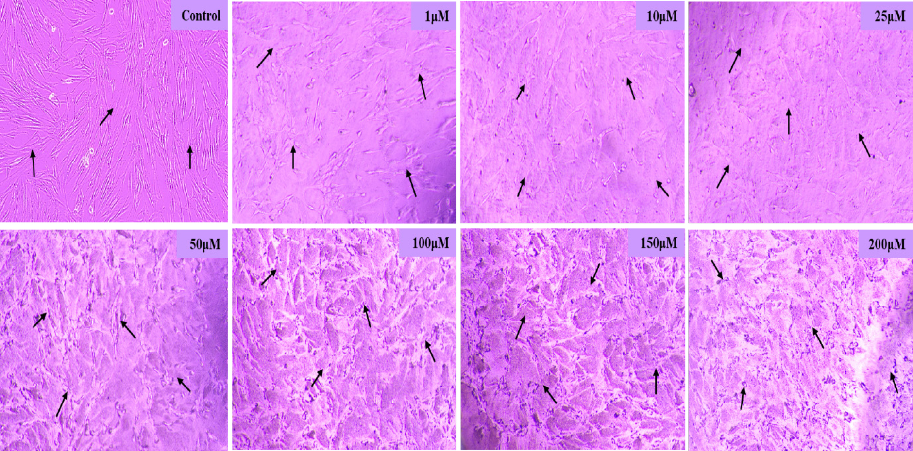Dose-dependent reduction in cell viability of PDL fibroblasts following 24 h exposure to arecoline (1-200 μM), as shown by MTT assay, with untreated control cells exhibiting the highest metabolic activity and progressively decreased viability observed at increasing arecoline concentrations.