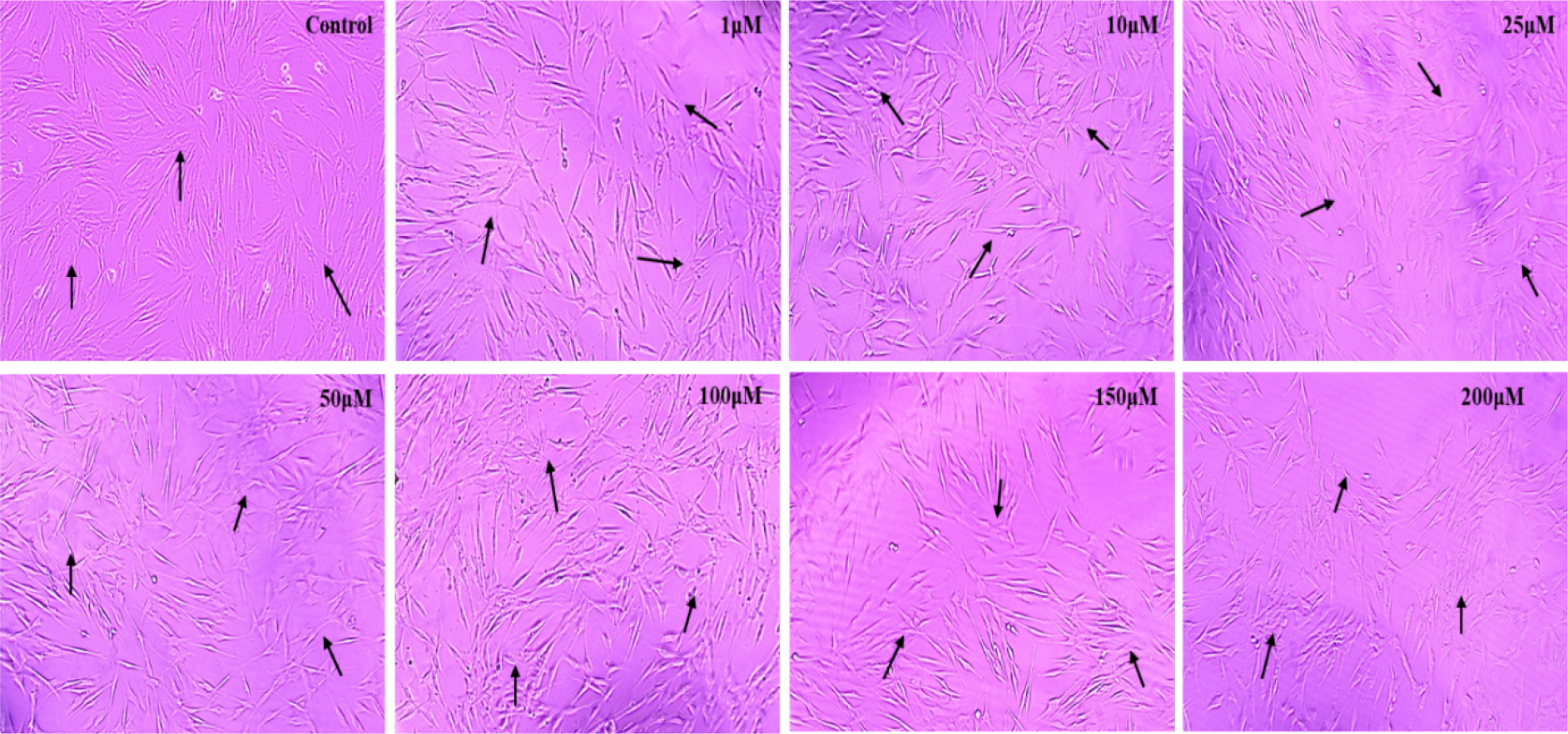 Dexamethasone (1μM) maintained near-normal cell viability in PDL fibroblasts after 24 hr, showing MTT values comparable to the untreated control, indicating no cytotoxic effect.