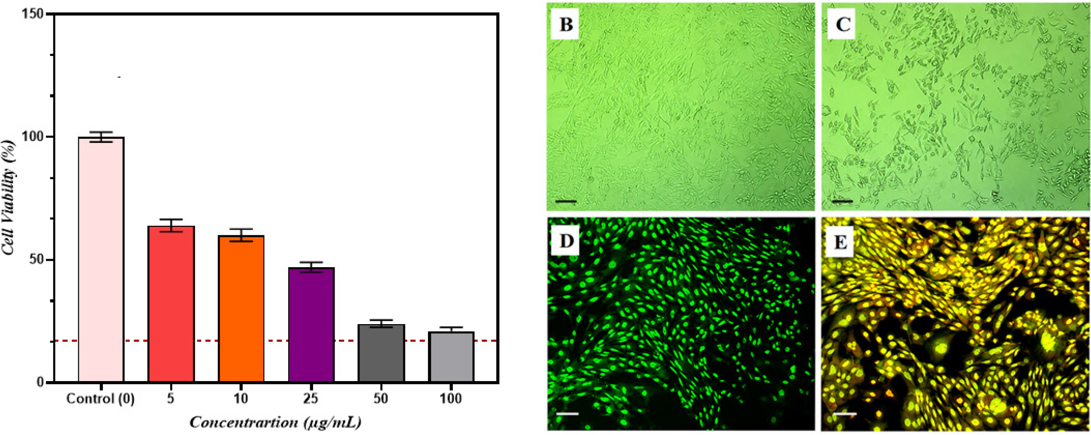 Anticancer activity of CuO nanoparticle-loaded CS/PVA hydrogel against A549 cells: (A) MTT cytotoxicity assay; (B) untreated cells; (C) treated cells; (D) AO/EtBr staining of control cells; (E) AO/EtBr staining of treated cells showing apoptosis.