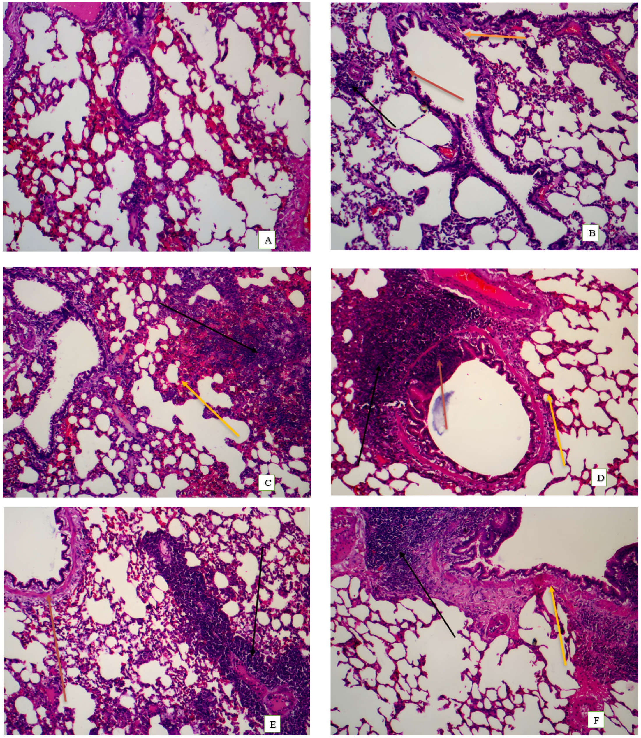 A: Normal control: normal architecture of alveoli, alveolar septa, and bronchioles, H&E, 100x. B: Induction control: Moderately high infiltration of inflammatory cells (black arrow), moderate peri-bronchial oedema (red arrow), Moderate alveolar septal thickening (yellow arrow). C: Standard: Mild infiltration of inflammatory cells (black arrow), Mild alveolar septal thickening (yellow arrow), H&E, 100x. D: DDZ 50 mg/kg: Moderate infiltration of inflammatory cells, Moderate peri-bronchial oedema (red arrow), Mild Alveolar septal thickening (yellow arrow), H&E, 100x. E: DDZ 100 mg/kg: Moderate infiltration of inflammatory cells, Mild peri-bronchial oedema (red arrow), H&E, 100x. F: DDZ 200 mg/kg: Mild infiltration of inflammatory cells, Mild Alveolar Septal Thickening (yellow arrow), H&E, 100x.